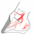 Laminitic Hoof